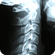 xray of spine