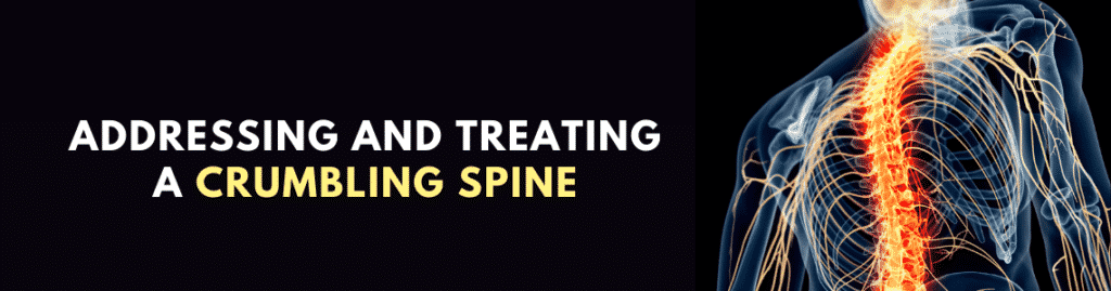 Addressing And Treating A Crumbling Spine