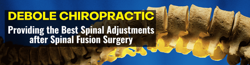 Debole Chiropractic | Providing the Best Spinal Adjustments after Spinal Fusion Surgery